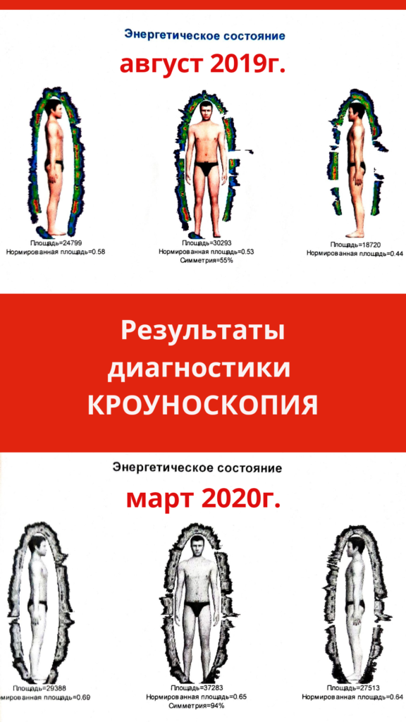 Кроуноскопия Кемерово фото ауры
